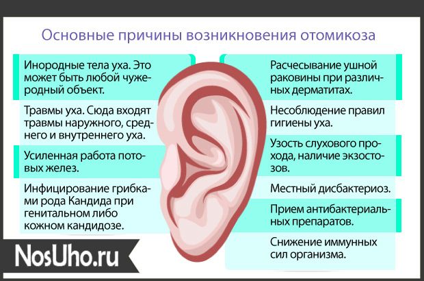 Зуд в ушах лечение препараты. Грибковые заболевания ушей. Грибковая инфекция в ушах.