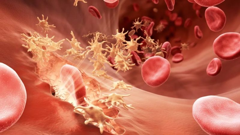 Гемофилия | Признаки и общие сведения