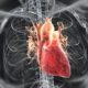 Ишемическая болезнь сердца : причины и признаки