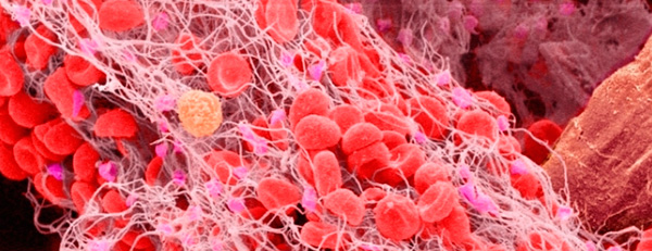 Фибриноген снижается в крови при