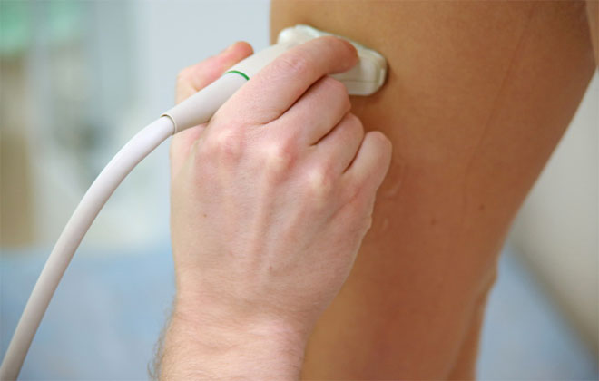 Флотация тромба что это такое