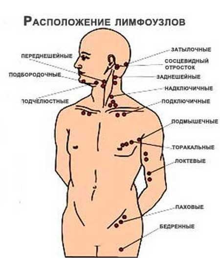 Хронический лимфаденит у детей