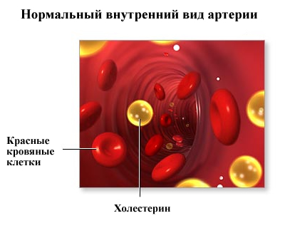 Холестерин ниже нормы что делать