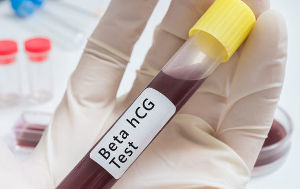 Хгч 500 какой срок беременности