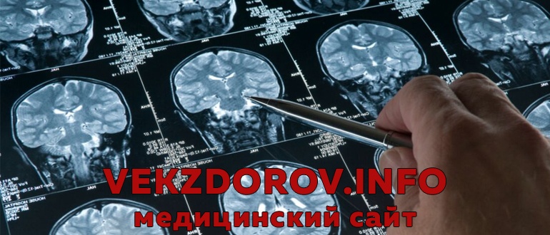 Ушиб головного мозга диагностика