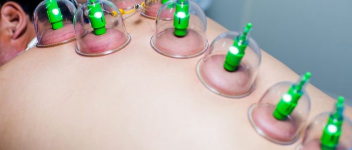 Хиджама при повышенном давлении