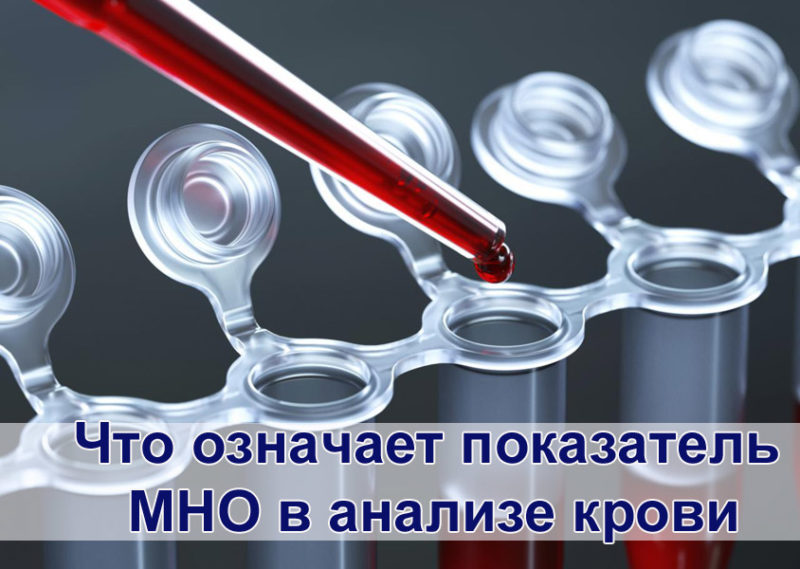 Что означает мно в анализе крови